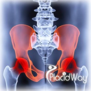 hip replacement cost
