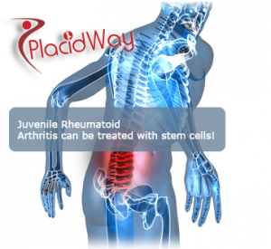 Juvenile rheumatoid arthritis stem-cell-Placid Way