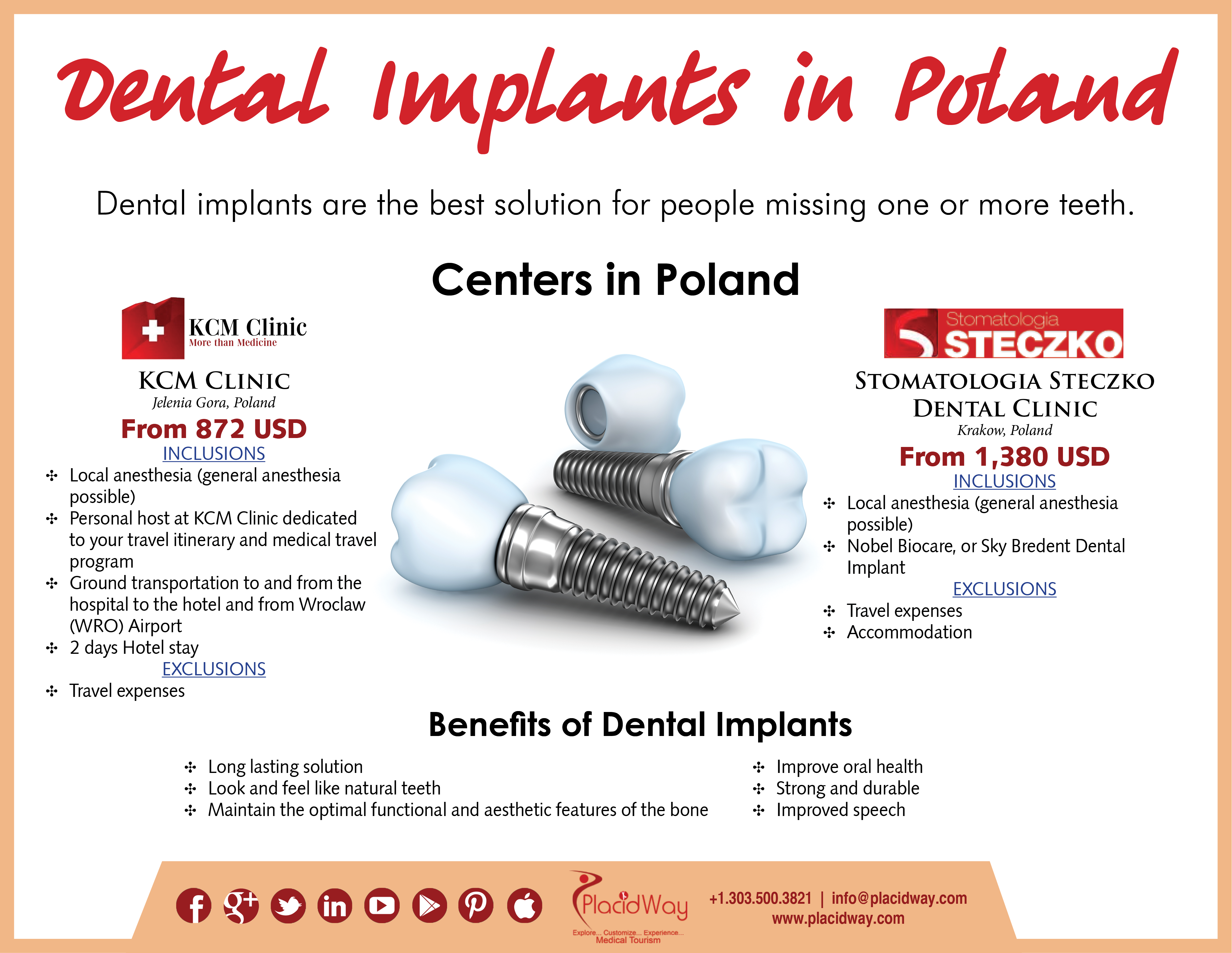 Infographics Dental Implants in Poland