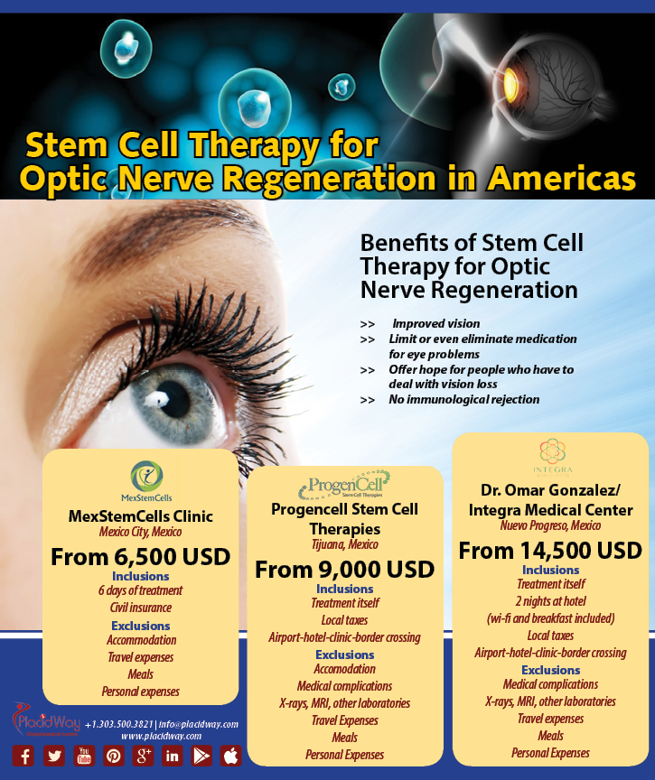 Infographics Stem Cell Therapy for Optic Nerve Regeneration in Americas