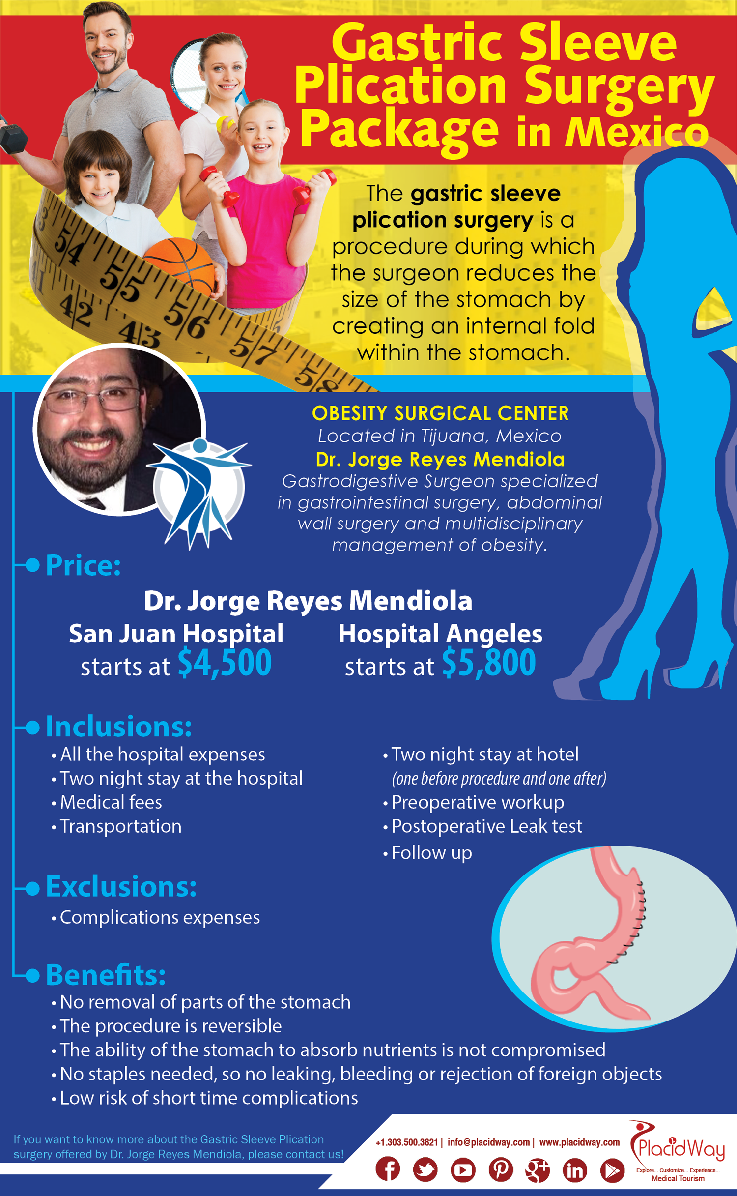 gastric-sleeve-plication-surgery-package-in-mexico-obesity-surgical