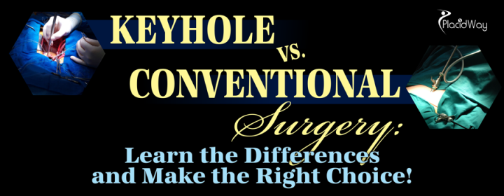 Keyhole vs Conventional Surgery Learn the Differences and Make the Right Choice