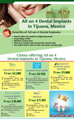 Infographics: All on 4 Dental Implants in Tijuana Mexico
