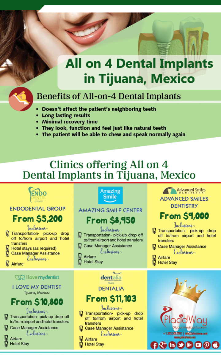 Infographics: All on 4 Dental Implants in Tijuana Mexico