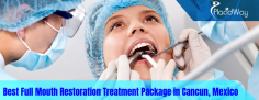 Safe and Effective Full Mouth Restoration Package in Cancun, Mexico