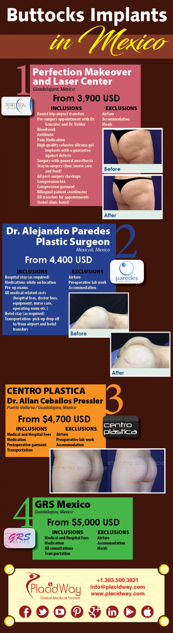 Infographics: Buttocks Implants in Mexico