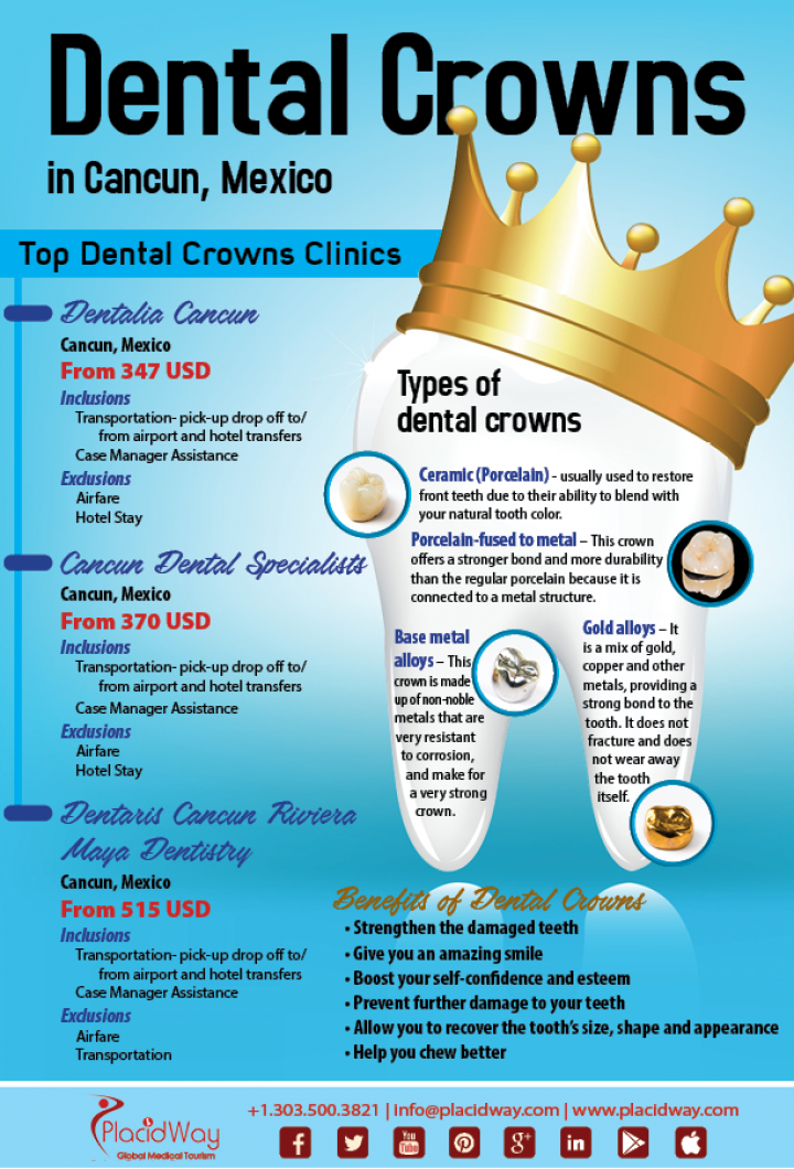 Infographics: Dental Crowns in Cancun Mexico