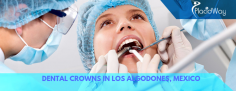 Best Packages for Dental Crowns in Los Algodones, Mexico
