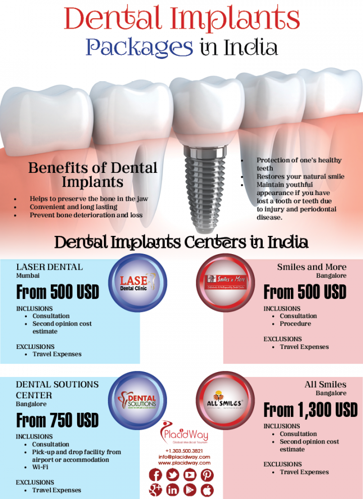 Infographics: Dental Implant Packages in India