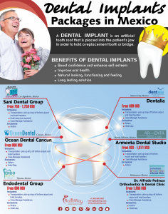 Infographics: Dental Implant Package in Mexico