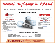 Infographics: Dental Implants in Poland