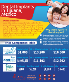 Infographics: Dental Implants in Tijuana Mexico