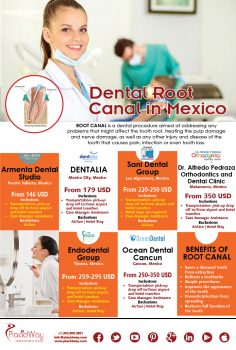 Infographics: Dental Root Canal in Mexico