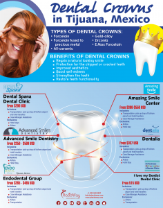 Infographics: Dental Crowns in Tijuana Mexico