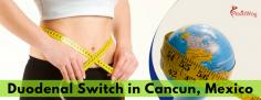 Popular Package for Duodenal Switch Surgery in Cancun, Mexico