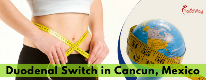 Popular Package for Duodenal Switch Surgery in Cancun, Mexico