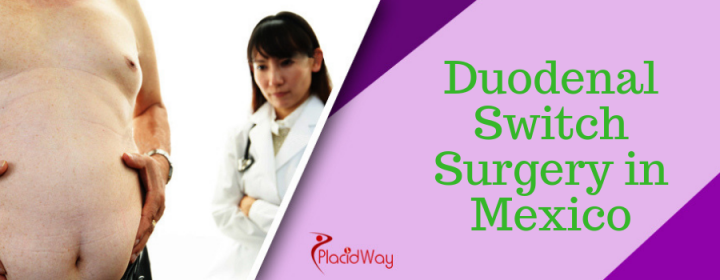 Affordable Duodenal Switch Surgery in Mexico