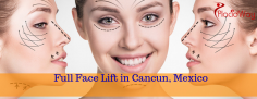 Most Affordable Face Lift Package in Cancun, Mexico