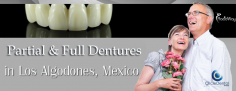 Full and Partial Dentures in Los Algodones Mexico