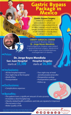 Infographics: Gastric Bypass Package in Mexico