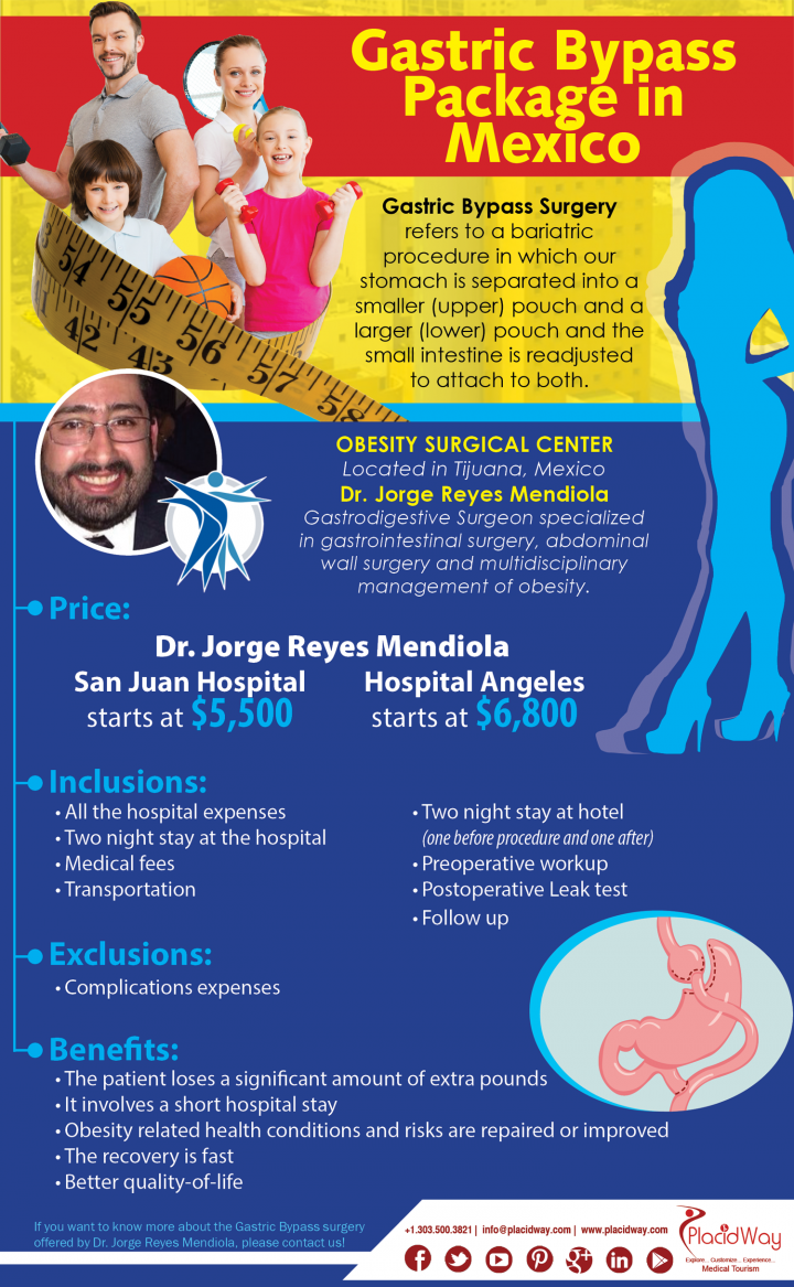 Infographics: Gastric Bypass Package in Mexico