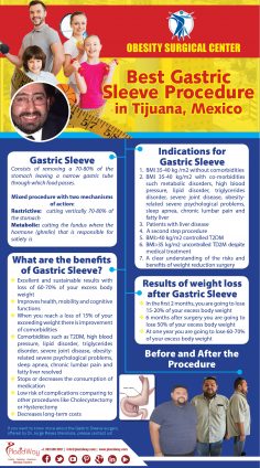 Infographics: Best Gastric Sleeve Procedure in Mexico