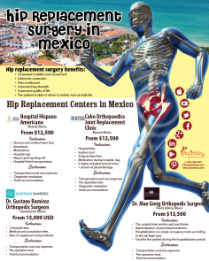 Infographics: Hip Replacement Surgery in Mexico