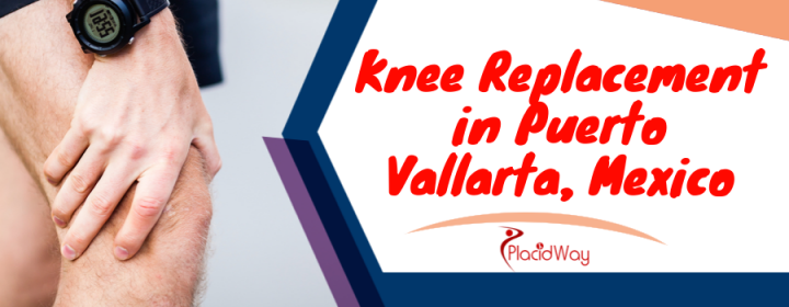Best Knee Replacement Package in Puerto Vallarta, Mexico