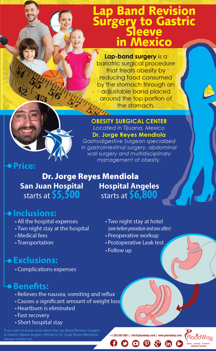 Infographics: Lap Band Revision Surgery to Gastric Sleeve in Mexico