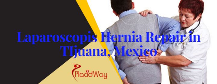 Most Affordable Laparoscopic Hernia Repair Package in Tijuana, Mexico