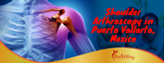 Best Shoulder Arthroscopy Package in Puerto Vallarta, Mexico