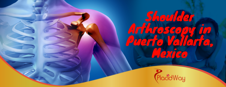 Best Shoulder Arthroscopy Package in Puerto Vallarta, Mexico