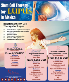 Infographics: Stem Cell Therapy for Lupus in Mexico