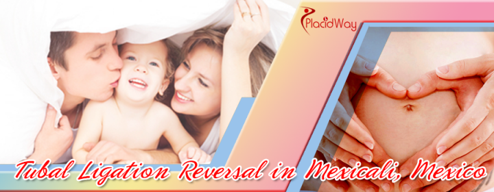 The Best Tubal Ligation Reversal Package in Mexicali, Mexico