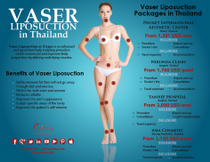 Infographics: Vaser Liposuction in Thailand