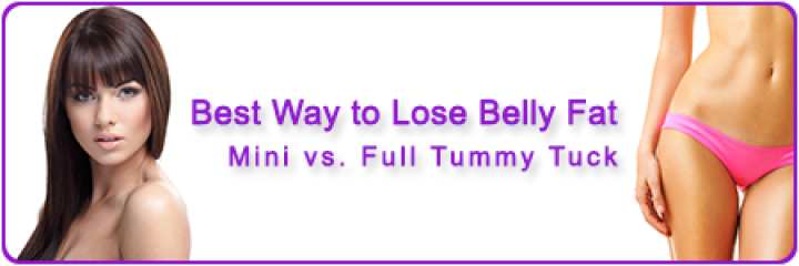 Best Way to Lose Belly Fat: Mini vs. Full Tummy Tuck