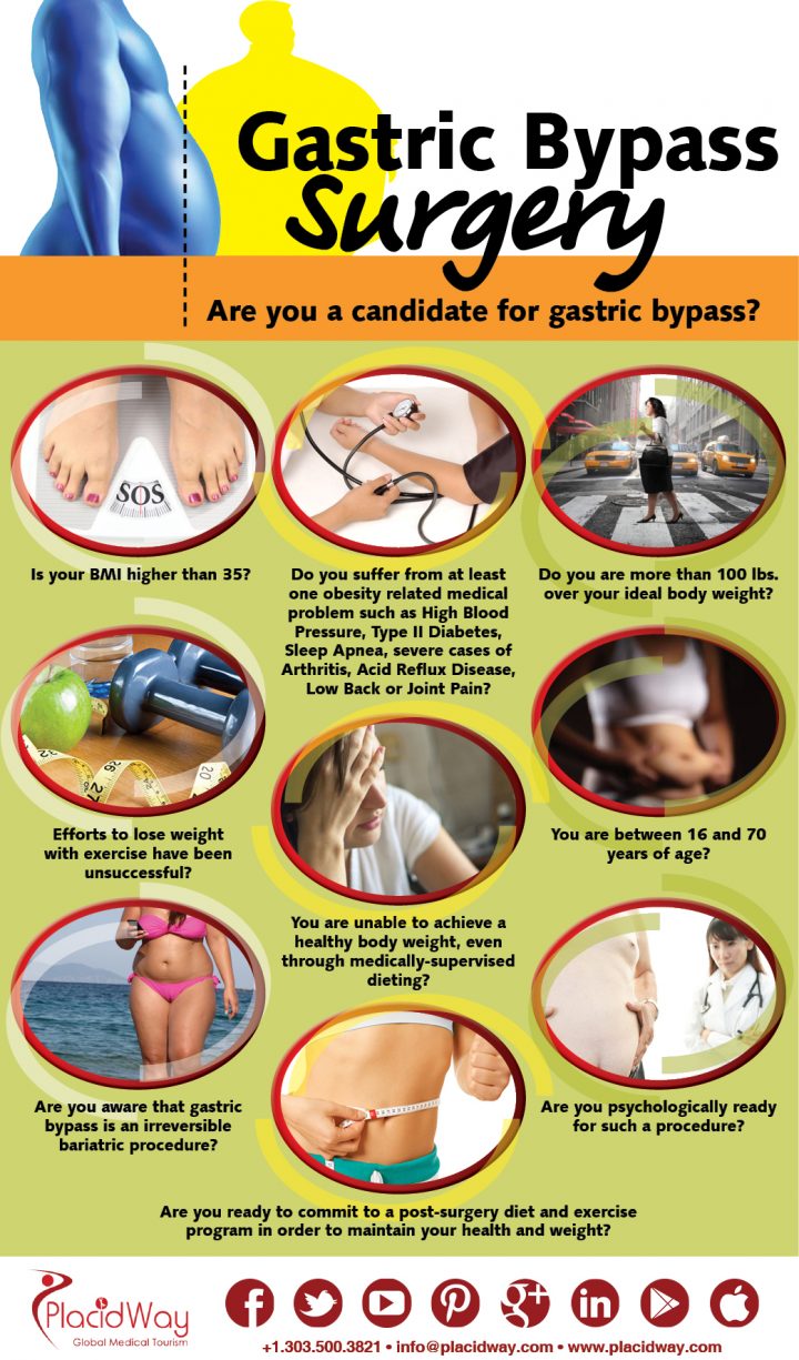 Infographics: Gastric Bypass Surgery