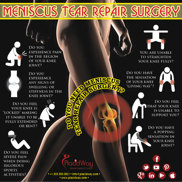Infographics: Meniscus Tear Repair Surgery Survey