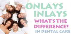 Onlays, Inlays in Dental Care… What’s the Difference?