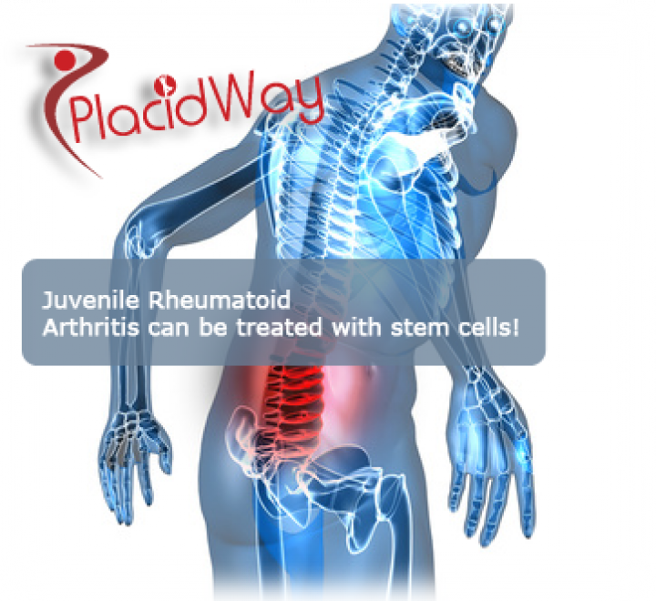 Juvenile Rheumatoid Arthritis Signs and Treatment