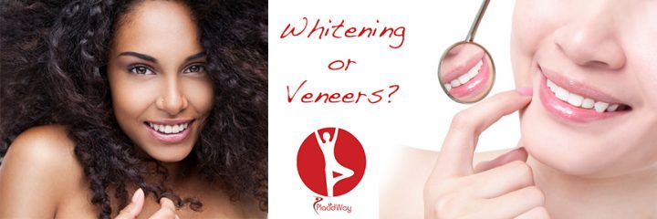 Dental Veneers vs. Teeth Whitening Treatments